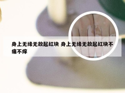 身上无缘无故起红块 身上无缘无故起红块不痛不痒