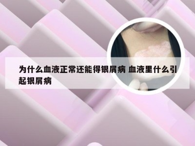 为什么血液正常还能得银屑病 血液里什么引起银屑病