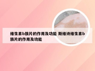 维生素b族片的作用及功能 斯维诗维生素b族片的作用及功能