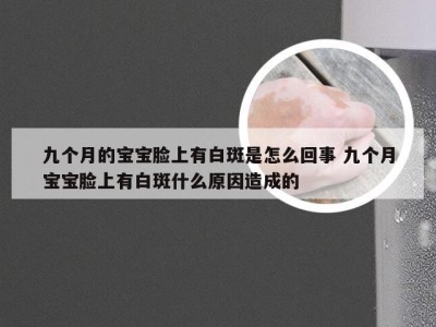 九个月的宝宝脸上有白斑是怎么回事 九个月宝宝脸上有白斑什么原因造成的