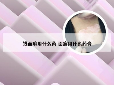 钱面癣用什么药 面癣用什么药膏