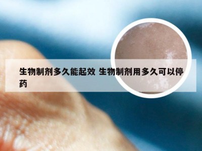 生物制剂多久能起效 生物制剂用多久可以停药