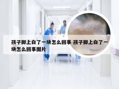 孩子脚上白了一块怎么回事 孩子脚上白了一块怎么回事图片