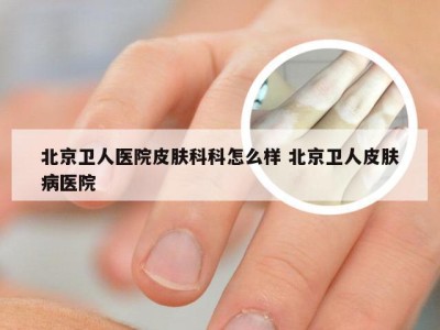 北京卫人医院皮肤科科怎么样 北京卫人皮肤病医院