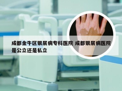 成都金牛区银屑病专科医院 成都银屑病医院是公立还是私立