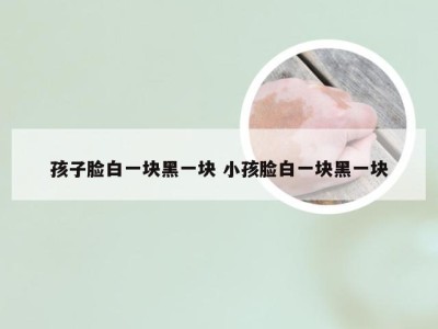 孩子脸白一块黑一块 小孩脸白一块黑一块