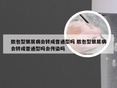 脓包型银屑病会转成普通型吗 脓包型银屑病会转成普通型吗会传染吗