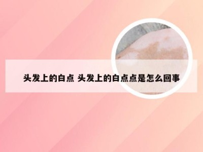 头发上的白点 头发上的白点点是怎么回事