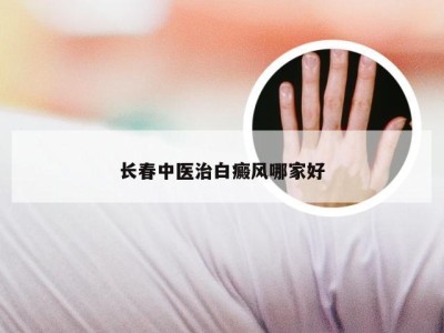 长春中医治白癜风哪家好