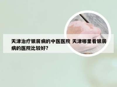 天津治疗银屑病的中医医院 天津哪里看银屑病的医院比较好?