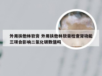 外用扶他林软膏 外用扶他林软膏检查肾功能三项会影响二氧化碳数值吗