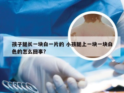 孩子腿长一块白一片的 小孩腿上一块一块白色的怎么回事?