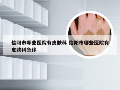 信阳市哪些医院有皮肤科 信阳市哪些医院有皮肤科急诊