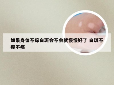 如果身体不痒白斑会不会就慢慢好了 白斑不痒不痛