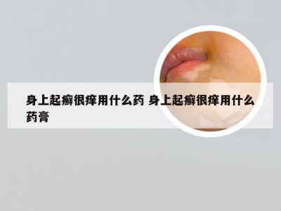 身上起癣很痒用什么药 身上起癣很痒用什么药膏