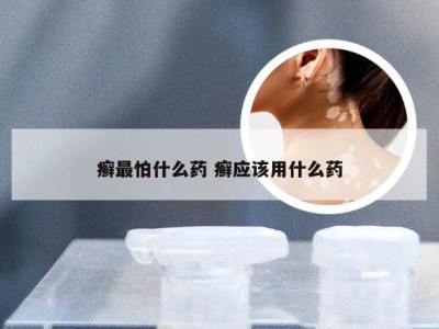 癣最怕什么药 癣应该用什么药