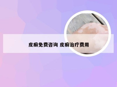 皮癣免费咨询 皮癣治疗费用