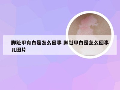 脚趾甲有白是怎么回事 脚趾甲白是怎么回事儿图片