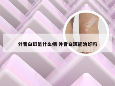 外音白斑是什么病 外音白班能治好吗