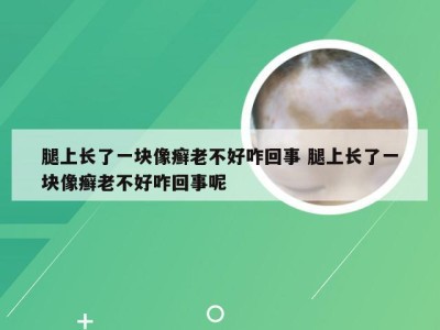 腿上长了一块像癣老不好咋回事 腿上长了一块像癣老不好咋回事呢