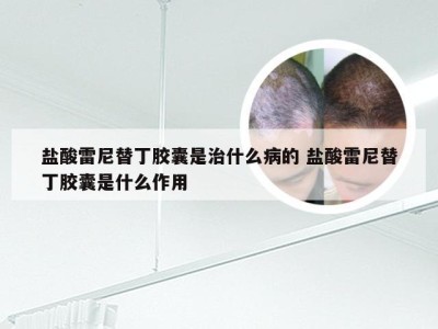 盐酸雷尼替丁胶囊是治什么病的 盐酸雷尼替丁胶囊是什么作用