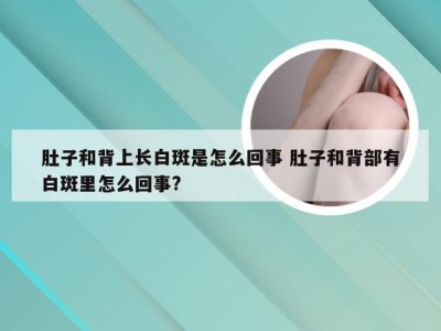 肚子和背上长白斑是怎么回事 肚子和背部有白斑里怎么回事?