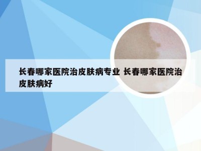 长春哪家医院治皮肤病专业 长春哪家医院治皮肤病好