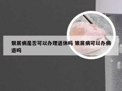 银屑病是否可以办理退休吗 银屑病可以办病退吗