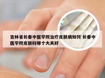 吉林省长春中医学院治疗皮肤病如何 长春中医学院皮肤科哪个大夫好