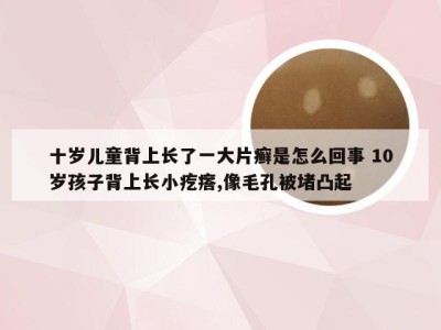 十岁儿童背上长了一大片癣是怎么回事 10岁孩子背上长小疙瘩,像毛孔被堵凸起