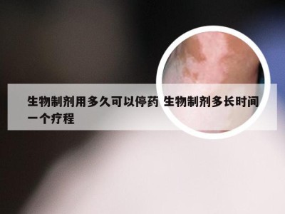 生物制剂用多久可以停药 生物制剂多长时间一个疗程