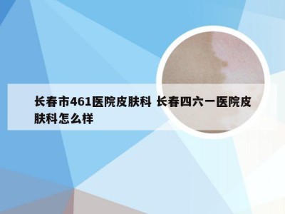 长春市461医院皮肤科 长春四六一医院皮肤科怎么样