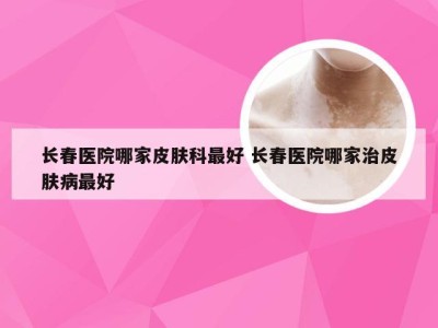 长春医院哪家皮肤科最好 长春医院哪家治皮肤病最好