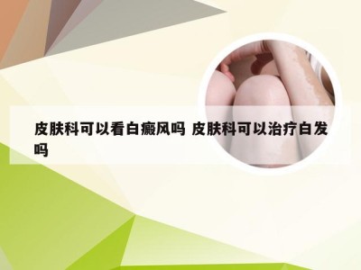 皮肤科可以看白癜风吗 皮肤科可以治疗白发吗