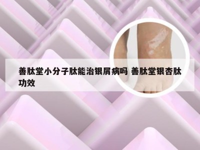 善肽堂小分子肽能治银屑病吗 善肽堂银杏肽功效