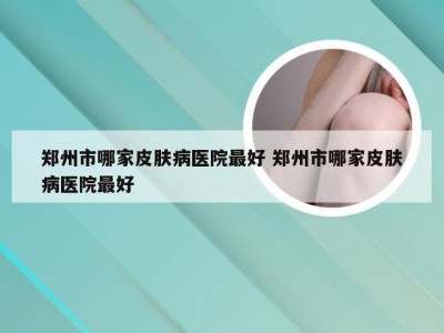 郑州市哪家皮肤病医院最好 郑州市哪家皮肤病医院最好