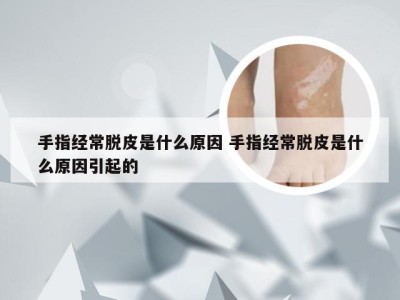 手指经常脱皮是什么原因 手指经常脱皮是什么原因引起的