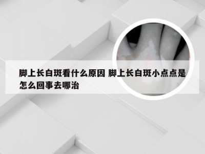 脚上长白斑看什么原因 脚上长白斑小点点是怎么回事去哪治