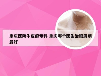 重庆医院牛皮癣专科 重庆哪个医生治银屑病最好