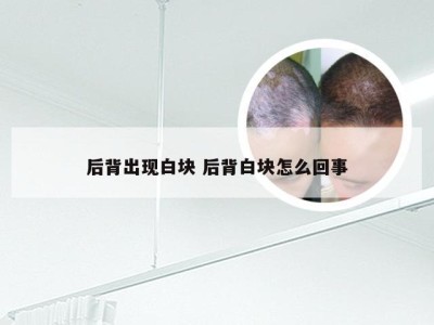 后背出现白块 后背白块怎么回事