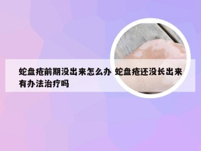 蛇盘疮前期没出来怎么办 蛇盘疮还没长出来有办法治疗吗