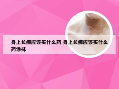 身上长癣应该买什么药 身上长癣应该买什么药涂抹