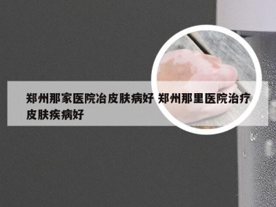 郑州那家医院冶皮肤病好 郑州那里医院治疗皮肤疾病好