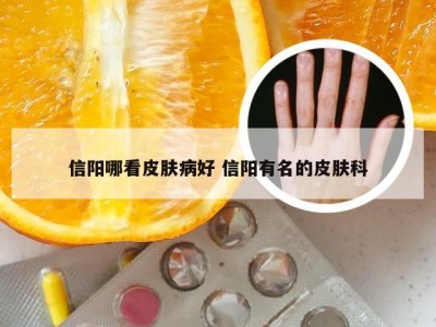 信阳哪看皮肤病好 信阳有名的皮肤科