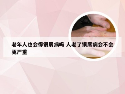 老年人也会得银屑病吗 人老了银屑病会不会更严重