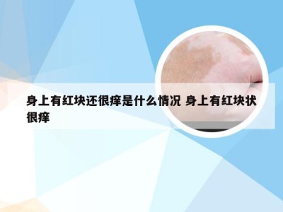 身上有红块还很痒是什么情况 身上有红块状很痒