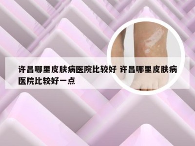 许昌哪里皮肤病医院比较好 许昌哪里皮肤病医院比较好一点