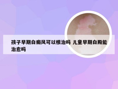 孩子早期白癜风可以根治吗 儿童早期白殿能治愈吗