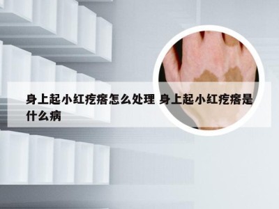 身上起小红疙瘩怎么处理 身上起小红疙瘩是什么病