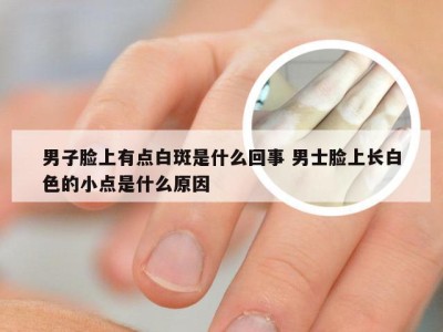 男子脸上有点白斑是什么回事 男士脸上长白色的小点是什么原因